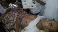 salah satu korban yang diterkam harimau di Madina beberapa waktu lalu salah satu korban yang diterkam harimau di Madina beberapa waktu lalu