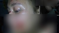 Wanita Berparas Cantik Ini Ngaku Babak Belur Dianiaya Suaminya 3 Screenshot 2018 09 17 Silitonga Tina Tikki marhallet so i nama tai ayam rasa sikolat