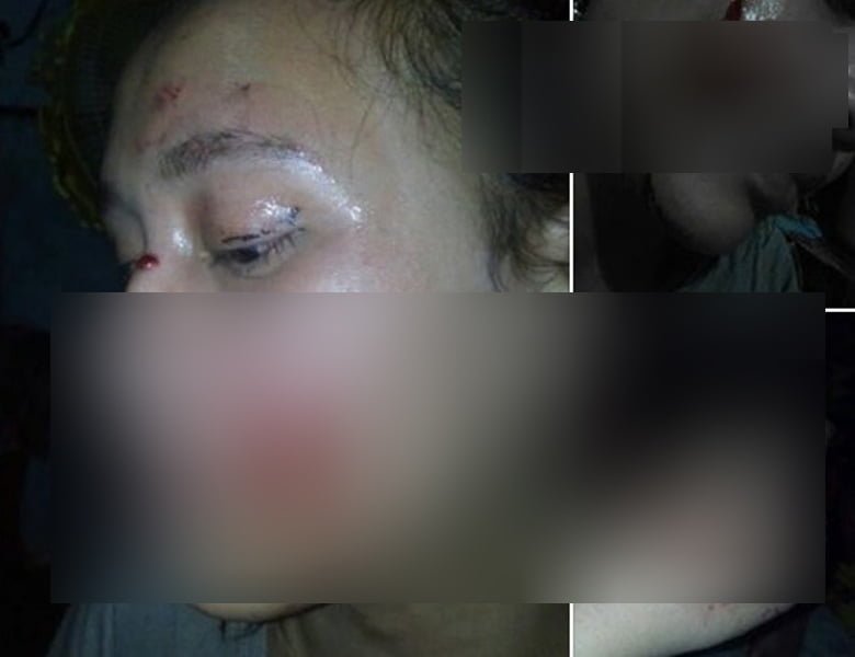 Wanita Berparas Cantik Ini Ngaku Babak Belur Dianiaya Suaminya 1 Screenshot 2018 09 17 Silitonga Tina Tikki marhallet so i nama tai ayam rasa sikolat