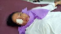 Suami Siram Istri dan Anaknya Dengan Air Keras, Mata Nyaris Buta 25 IMG 20220108 152244